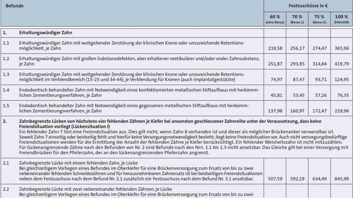 Festzuschuss Zahnersatz Tabelle 2023 Pdf